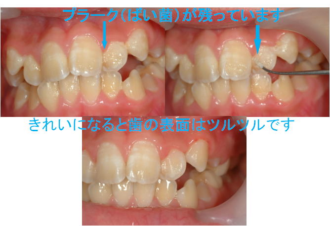 一般歯科